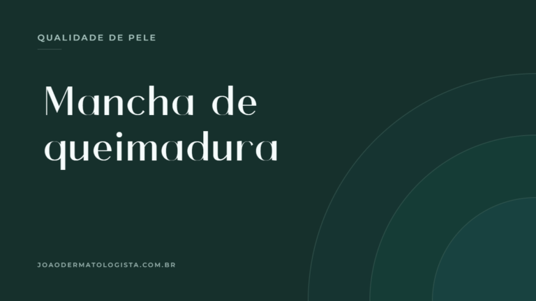 Mancha de queimadura