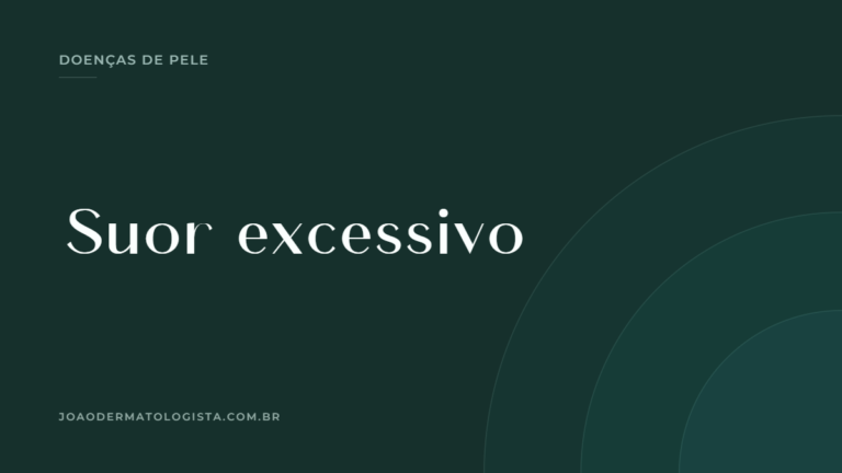 Suor excessivo — artigo do Dr. João Victor Bezerra