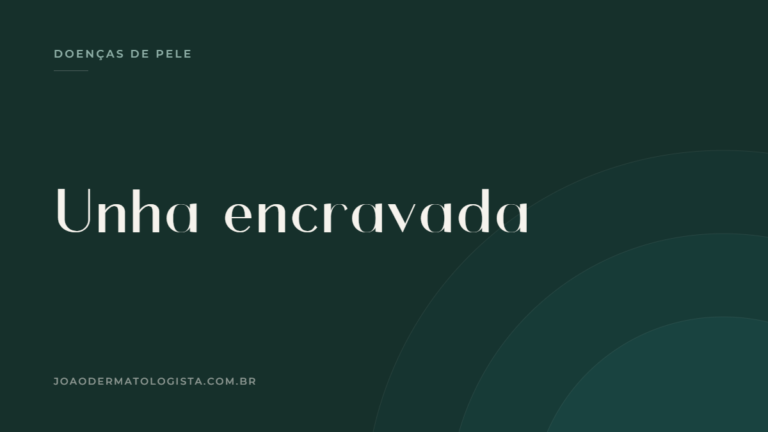 Capa do artigo sobre unha encravada