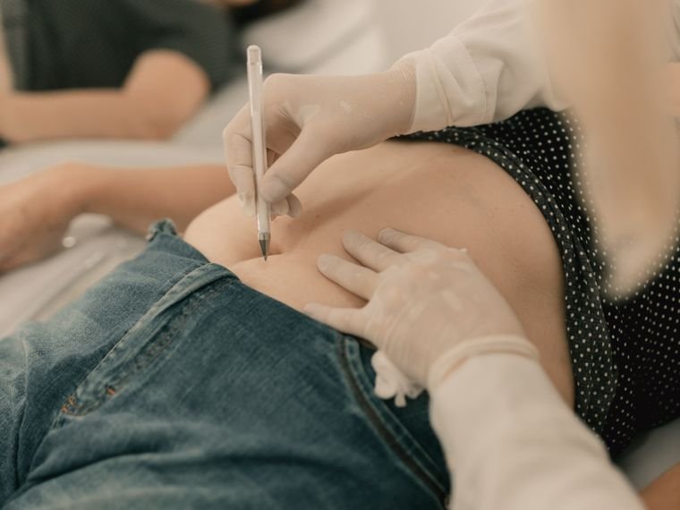 A aplicação: produto diluído e distribuído na área