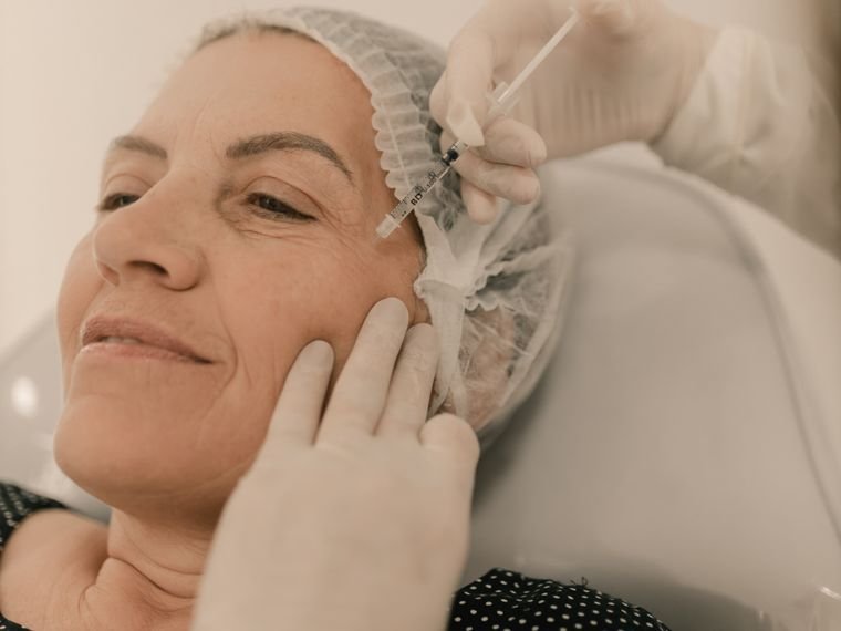 A toxina: relaxa o músculo que forma a ruga, como nos pés de galinha