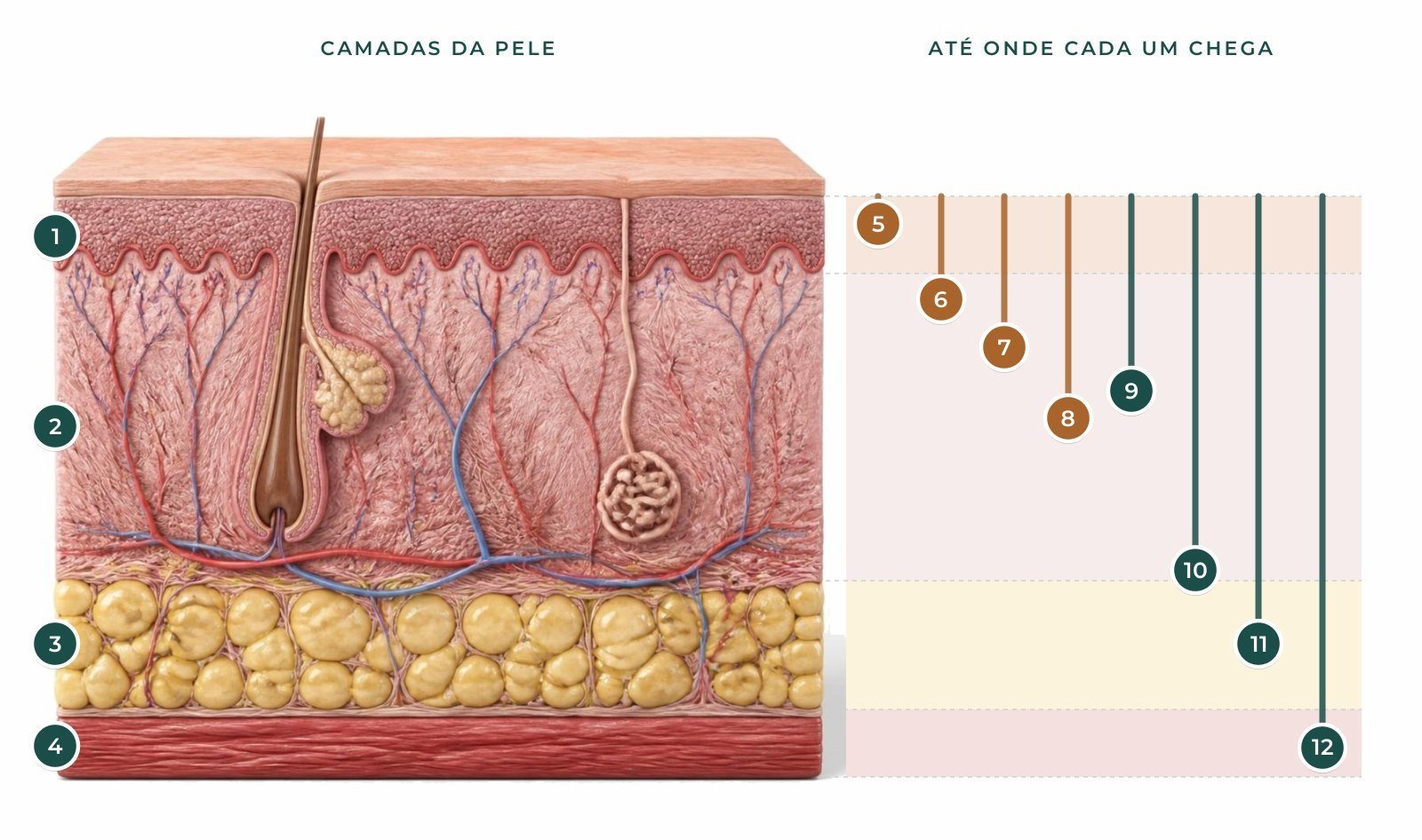 Ilustração em corte das camadas da pele com a profundidade aproximada de peeling, microagulhamento, laser de CO2, skinbooster, bioestimulador, preenchedor e toxina botulínica
