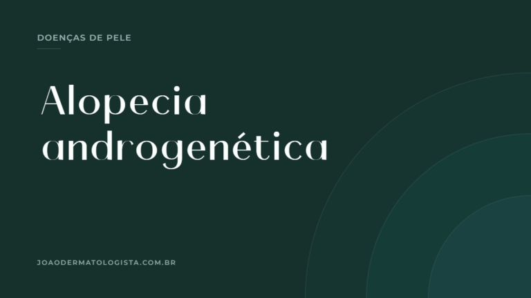 Capa do artigo sobre alopecia androgenética — Dr. João Victor Bezerra, médico dermatologista em Londrina