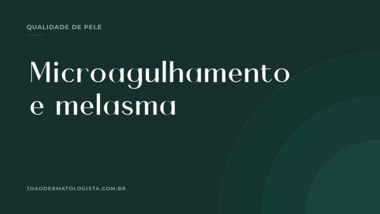 Capa do artigo sobre microagulhamento em quem tem melasma