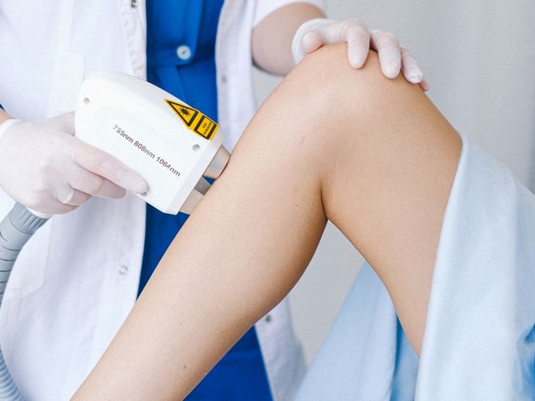 Depilação a laser: menos pelo, menos encravamento
